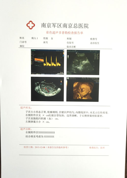 激光彩超膠片 拷貝.jpg